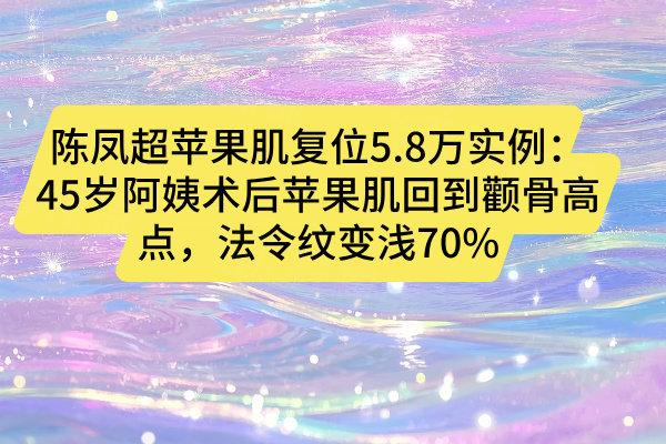 陳鳳超蘋果肌復(fù)位5.8萬實例：45歲阿姨術(shù)后蘋果肌回到顴骨高點，法令紋變淺70%
