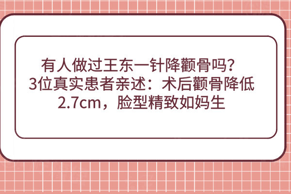 有人做过王东一针降颧骨吗？3位真实患者亲述：术后颧骨降低2.7cm，脸型精致如妈生