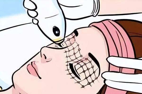 美拉美超聲刀是哪國的品牌?來自以色列的品牌！專門用于抗衰的項(xiàng)目