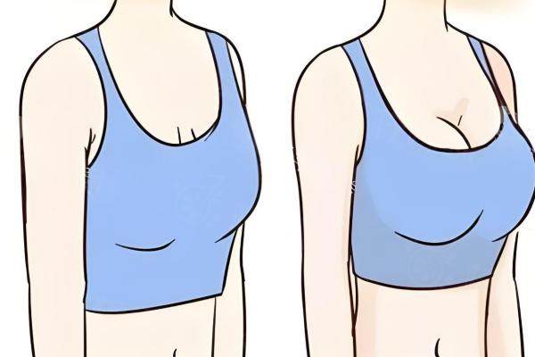 花了9萬(wàn)找欒杰做脂肪隆胸，一次就達(dá)到理想胸型！高存活率技術(shù)真相揭秘！