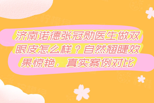 濟(jì)南諾德張冠勛醫(yī)生做雙眼皮怎么樣？自然翹睫效果驚艷，真實(shí)案例對比