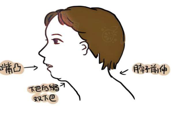 正颌手术需要多少钱？揭秘正颌手术费用+全过程，看一年后五官变了的真相