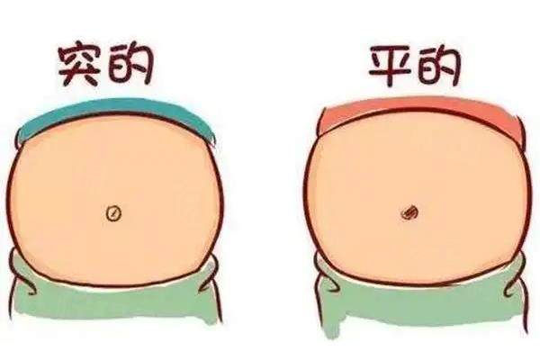 西安刘宾腹壁成形做的怎么样?20年经验+分层缝合技术,价格4万起!