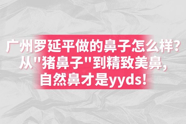 广州罗延平做的鼻子怎么样?从"猪鼻子"到精致美鼻,自然鼻才是yyds!