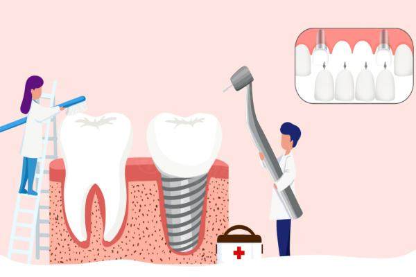 鼎植口腔醫(yī)院價目表更新：種植牙價格1880|牙齒矯正費(fèi)用6600元起