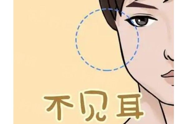 貼面耳怎么改善？非手術(shù)方法及手術(shù)矯正可自行選擇，價(jià)格3500起