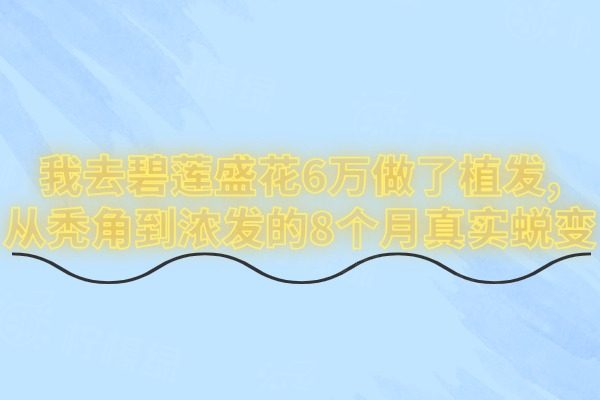 我去碧莲盛花6万做了植发,从秃角到浓发的8个月真实蜕变
