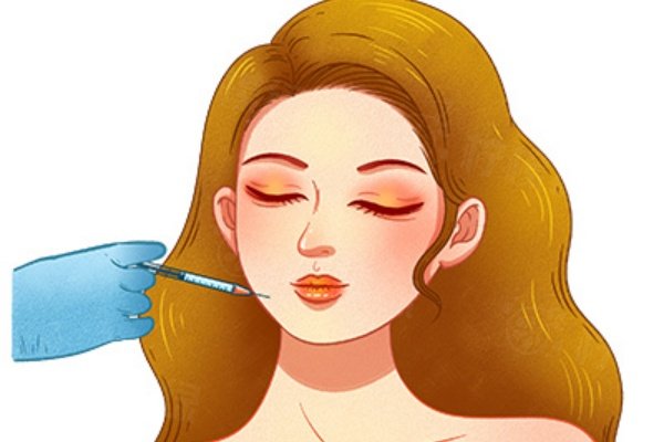 优妮金玻尿酸适合打哪里？可填充唇部/泪沟/法令纹等部位|不易移位