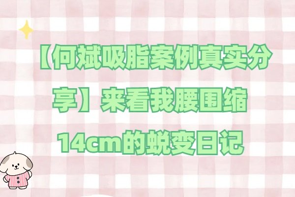 【何斌吸脂案例真实分享】来看我腰围缩14cm的蜕变日记