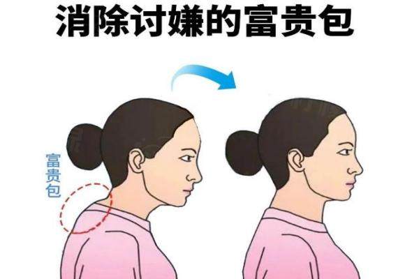 富貴包能消除掉嗎?揭秘5種科學(xué)方法+3個避坑指南,看完不花冤枉錢！