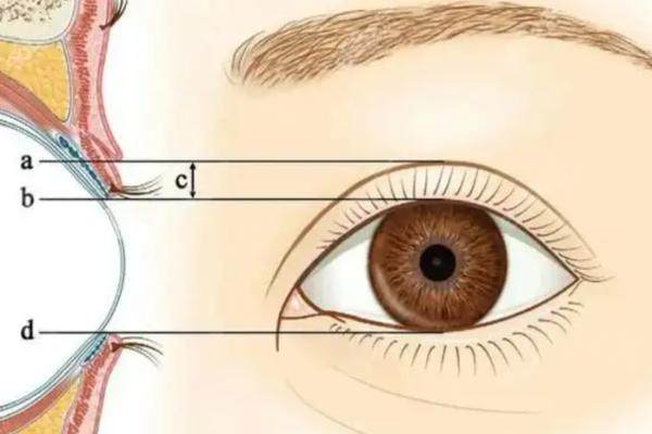 合肥曹林醫(yī)生口碑評價怎么樣？10000+修復案例95%閉眼無痕，附合肥曹林醫(yī)生雙眼皮修復價格