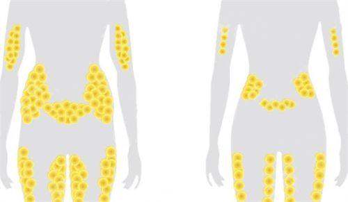 龙华新医生做吸脂多少钱？1 - 2个部位1W+/6 - 8个部位3W+