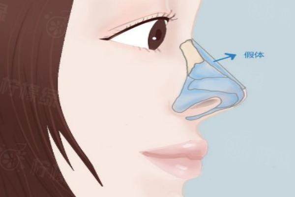 蘇州龔祥醫(yī)生做鼻綜合怎么樣？揭秘其鼻綜合價格及超詳細坐診醫(yī)院地址