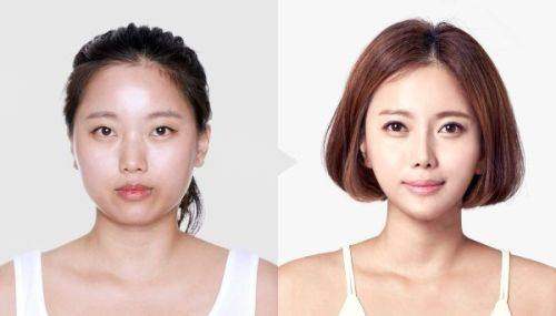 二、張賀醫(yī)生做人中價格？