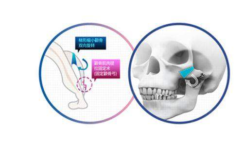 何萬華富貴包做的好嗎？獨(dú)家技術(shù):3D紅外導(dǎo)航+黃金微雕,價(jià)格/效果/排名一覽