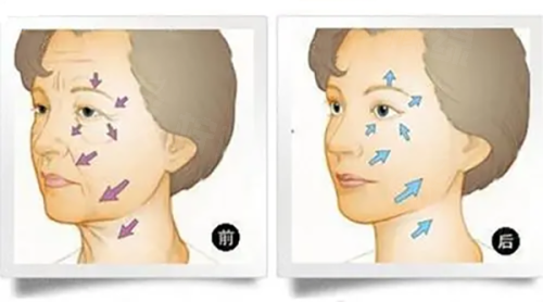 青島做拉皮手術(shù)哪里好?青島華顏美/青島伊美爾/青島諾德等醫(yī)院都上榜！ 