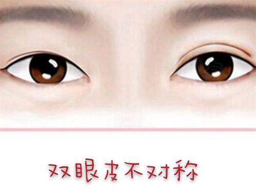 青島諾美德醫(yī)療美容醫(yī)院價格表:埋線雙眼皮2.6k/膨體隆鼻9k/假體隆胸1.2w+