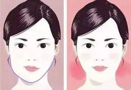 合肥恒美雙眼皮誰做的好？廖亞敏醫(yī)生經(jīng)驗(yàn)足，價格1500起效果自然！