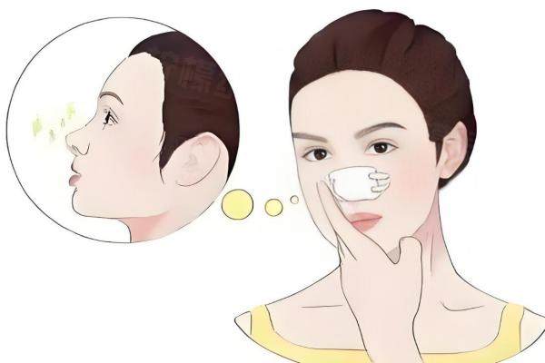 盧元?jiǎng)傖t(yī)生鼻子做的好看嗎？好看！ 膨體+肋軟骨組合技術(shù)，立體鼻型終身保質(zhì)！