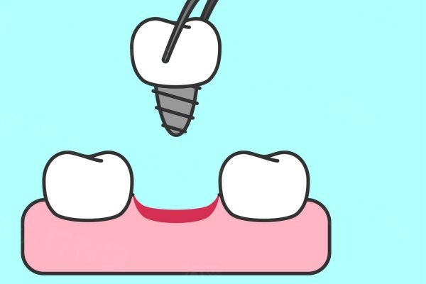 珠海諾貝爾口腔醫(yī)院價(jià)格表：種植牙3.98k+牙齒矯正8.8k+