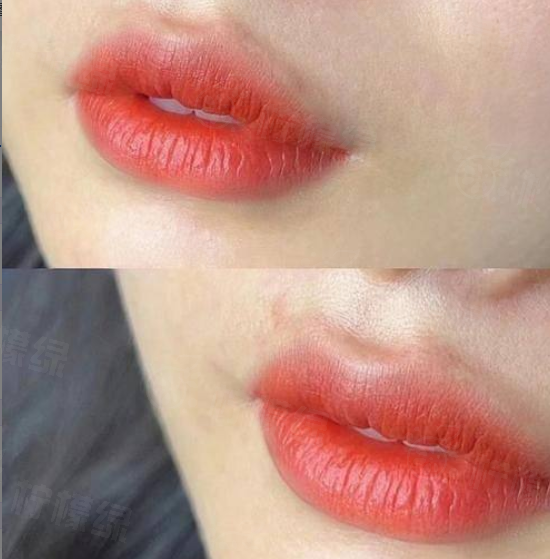 北京侯智慧醫(yī)生擅長私密整形嗎?當然!坐診北京嘉禾,專業(yè)實力強勁+經(jīng)驗豐富