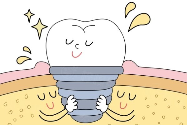 深圳種牙可以醫(yī)保報(bào)銷嗎？可用醫(yī)療支付，盤點(diǎn)深圳種牙超棒的醫(yī)院，看完不踩坑！ 