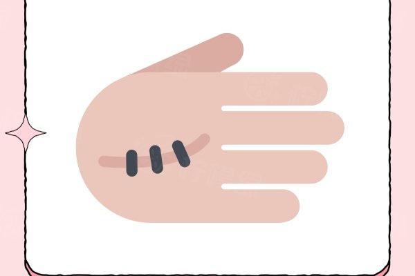 深圳悅爾疤痕胎記?？圃趺礃樱空?guī)靠譜，醫(yī)院口碑+地址分享！