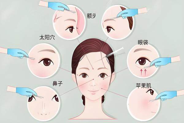 上海王洪整形醫(yī)生在上海容妍與滬中坐診，內(nèi)窺鏡高難度修復手術(shù)近萬例，值得預約！