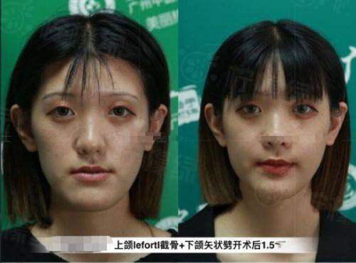 二、沈陽(yáng)私密整形醫(yī)院排名前十位