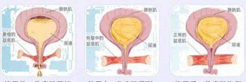 汪樹(shù)杰和裴柄萬(wàn)雙眼皮修復(fù)誰(shuí)厲害？口碑都好但風(fēng)格有別，汪樹(shù)杰8000起，裴柄萬(wàn)18000起 