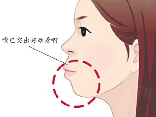 黃娟醫(yī)生做雙眼皮怎么樣？技術(shù)獲認(rèn)可，多例成功案例見證自然靈動美！ 