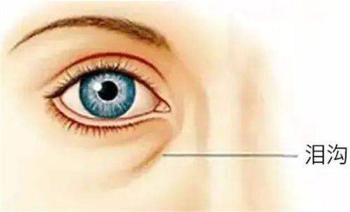 二、黃娟醫(yī)生做雙眼皮技術(shù)好嗎