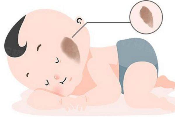 國內(nèi)去胎記醫(yī)院十大排名揭秘：前三家竟是美萊醫(yī)療美容醫(yī)院、藝星醫(yī)療美容醫(yī)院和伊美爾醫(yī)療美容醫(yī)院，太牛啦！