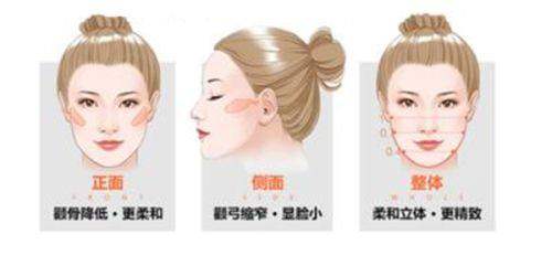 二、北京禾美嘉全身吸脂多少錢：