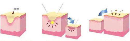 北京禾美嘉價位表：雙眼皮手術(shù)5000元起、吸脂瘦身6800元起、假體隆胸36000元起 