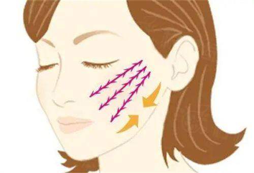 網(wǎng)兜提升術和韌帶提升是一樣的嗎？網(wǎng)兜提升5000-3萬+韌帶提升16900-45000+網(wǎng)兜副作用少易恢復 