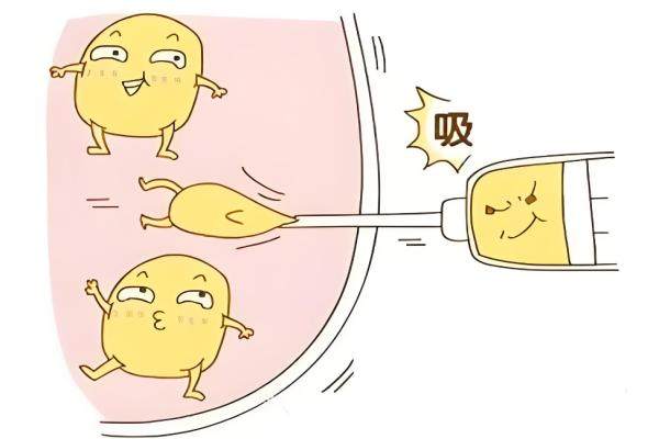 鄧晟華面部吸脂技術怎么樣？真實案例點評與收費標準全解析