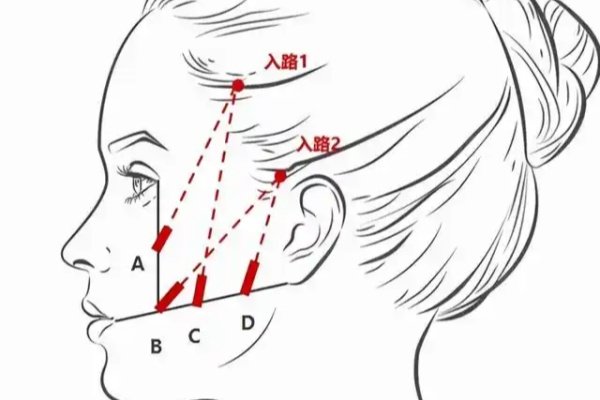 武漢愛美匯瞿敏醫(yī)生做提眉咋樣？技術(shù)自然持久滿意度高，價格 3000元起