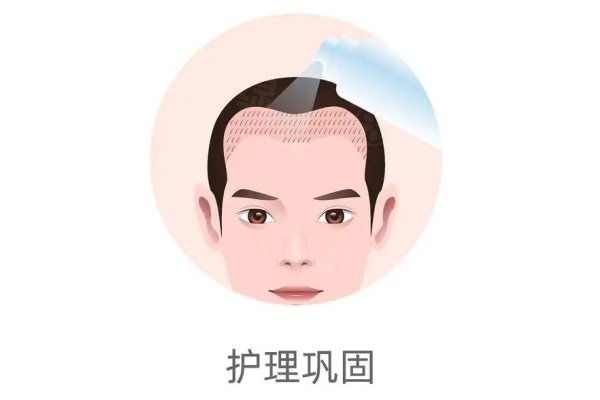 長沙雍禾植發(fā)收費價目表：美人尖微針種植15元起/毛囊|眉毛微針種植12000+