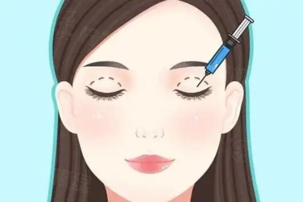 成都李波雙眼皮口碑評價：解決痛點(diǎn)獲好評！附成都李波醫(yī)生雙眼皮手術(shù)掛號攻略