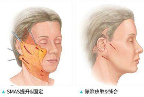 二、李萬強醫(yī)生技術(shù)怎么樣？深入解析其特色與優(yōu)勢m.sanboo.cn/