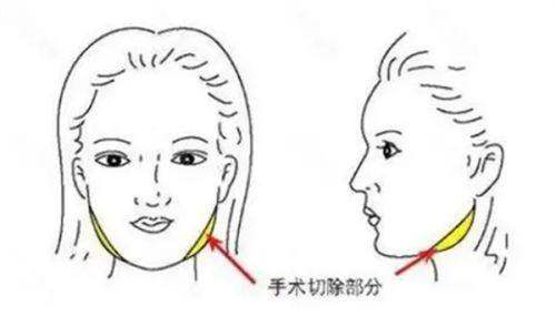 怎么預約張立彬醫(yī)生？官網(wǎng)/公眾號均可預約，門診時間和收費參考都在這