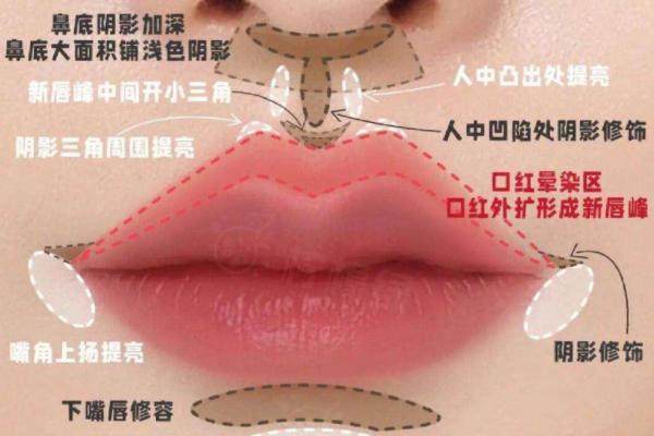 埋線人中縮短術全過程看人中埋線怎么埋線，我實測做完人中窩埋線恢復要多久？