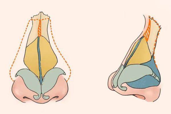 西安霍玉旺醫(yī)生在哪家醫(yī)院？長(zhǎng)安醫(yī)院霍玉旺做鼻子怎么樣？20年經(jīng)驗(yàn)案例多