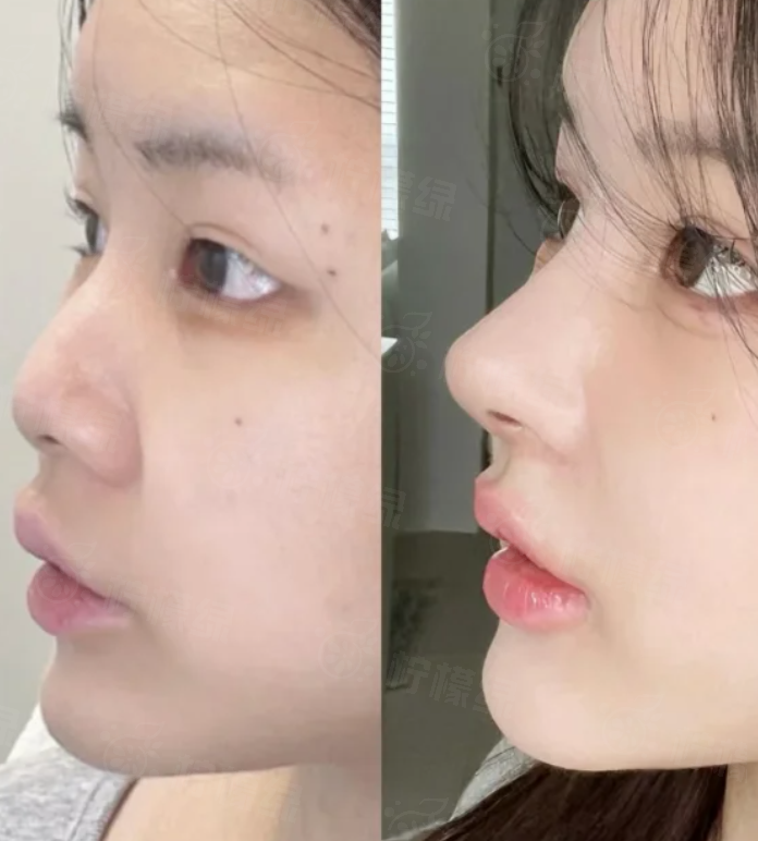 二、廣州軍美整形醫(yī)院的患者教育體系有何特色？