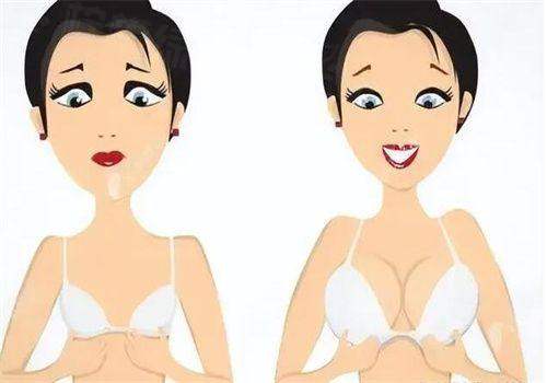 二、黃名斗醫(yī)生的胸部整形技術(shù)特色m.sanboo.cn/