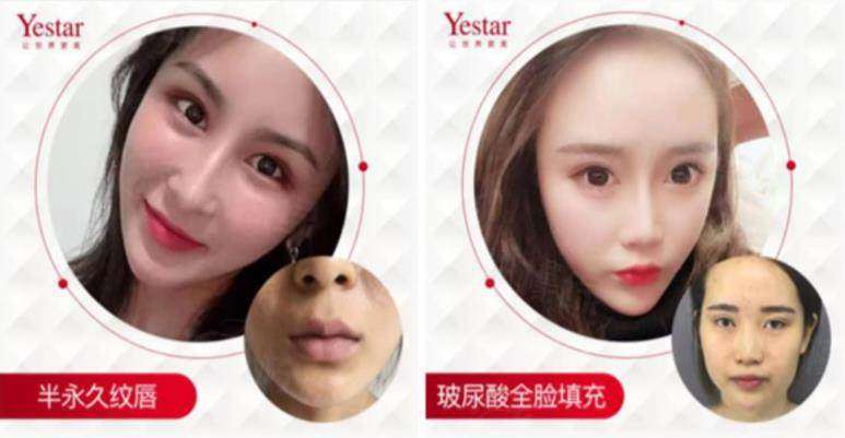 二、深圳藝星醫(yī)療美容醫(yī)院電話號碼為什么值得存進通訊錄？