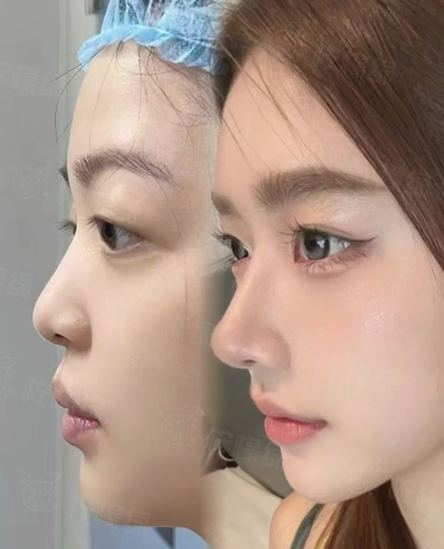 三、云南銅雀臺美容整形醫(yī)院技術(shù)好，還有這些“放心理由”