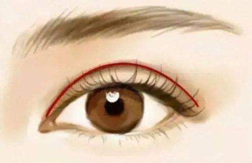 黃名斗做雙眼皮去眼袋咋樣？技術(shù)精細恢復(fù)快，效果超自然讓人美出新高度！ 