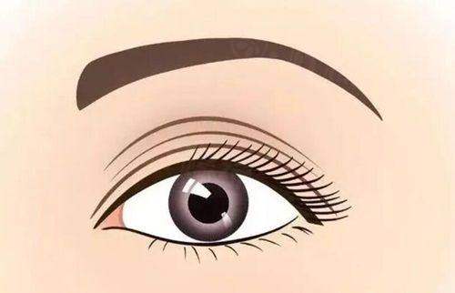 北京豐聯(lián)麗格師麗麗怎么樣？近20年經(jīng)驗(yàn)，眼部整形與修復(fù)超厲害！ 